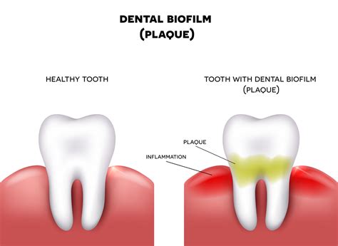 tcb for dental meaning